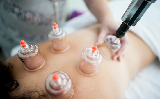 Cupping with Massage